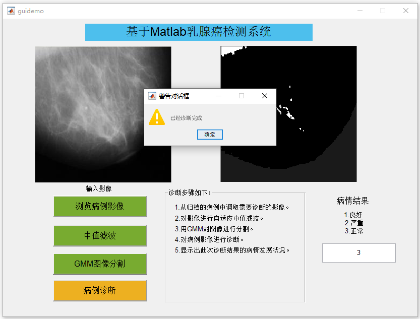 檢測結(jié)果.PNG